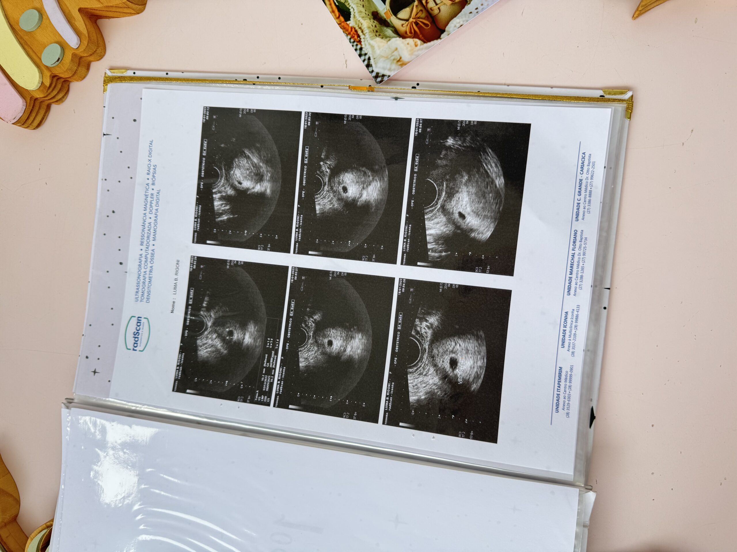 Porta Documentos + Caderneta Gestante - Imagem 6
